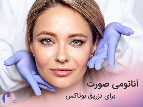 تصویر مناطق تزریق بوتاکس