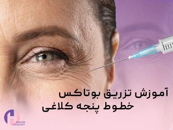 آموزش تزریق بوتاکس پنجه کلاغی