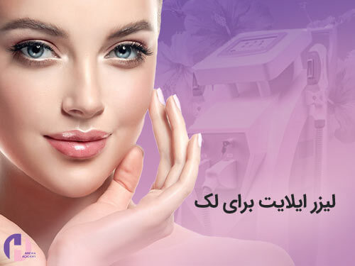 تصویر لیزر ایلایت برای لک