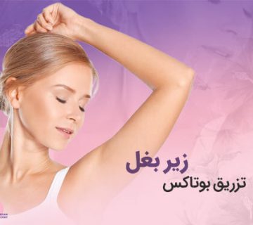 تصویر تزریق بوتاکس زیر بغل