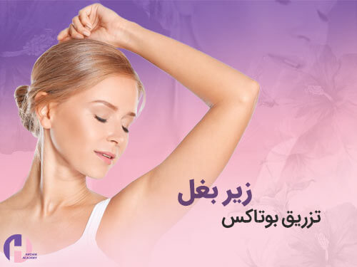 تصویر تزریق بوتاکس زیر بغل