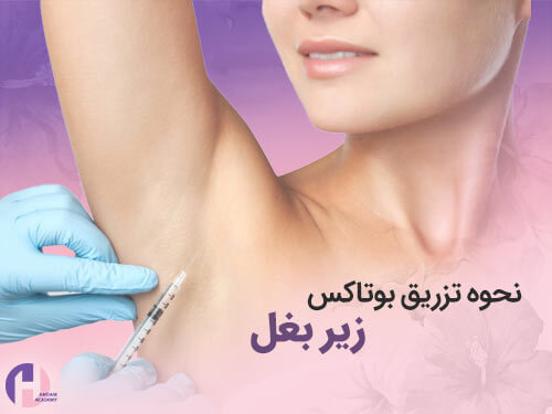 تصویر نحوه تزریق بوتاکس زیر بغل
