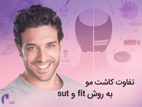 تصویر تفاوت کاشت مو به روش fit و sut