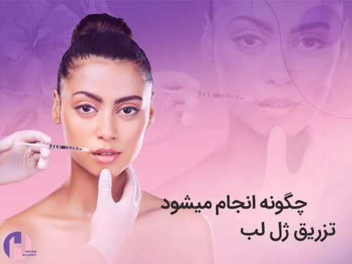 تصویر تزریق ژل لب انجام می شود