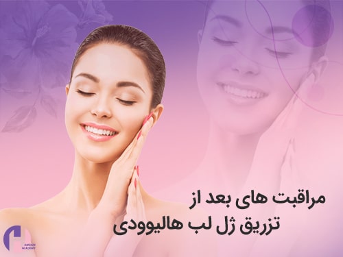 تصویر مراقبت های بهد از تزریق ژل لب به سبک هالیوود