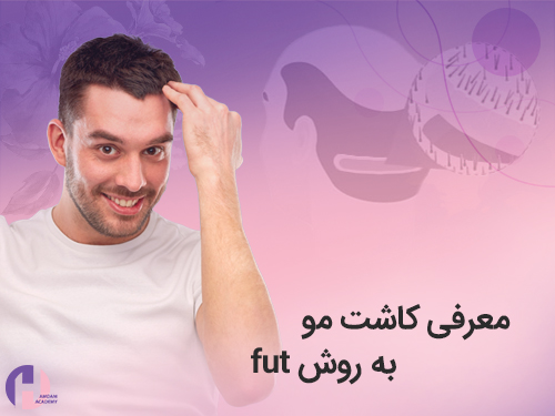 تصویر کاشت مو به روش fut