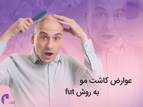 تصویر عوارض و خطرات کاشت مو fut