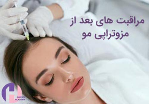 تصویر مراقبت های بعد از مزونراپی مو 