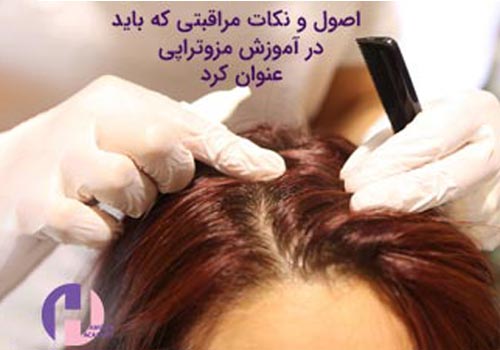 تصویر اصول و نکات مراقبتی بعد از مزوتراپی مو