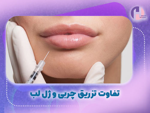 تصویر تزریق تفاوت ژل لب با چربی
