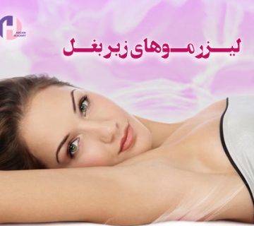 تصویر لیزر موهای زیر بغل