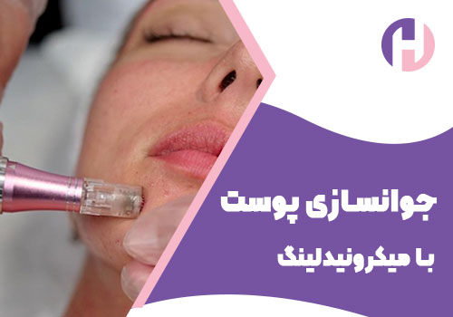 تصویر جوانسازی پوست با میکرونیدلینگ