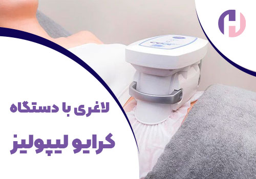 تصویر لاغری با دستگاه کرایولیپولیز