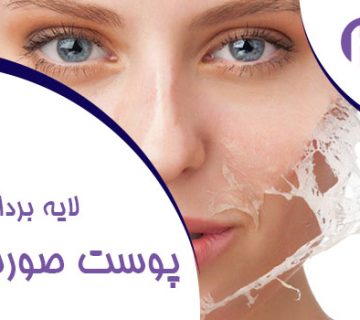 لایه برداری و پیلینگ پوست صورت