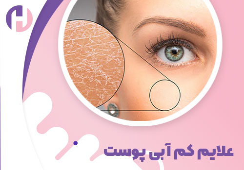 تصویر علائم کم آبی پوست