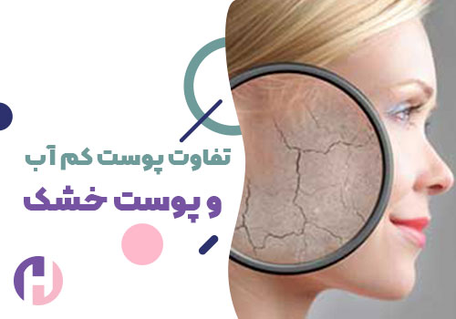 تصویر تفاوت پوست کم آب و پوست خشک
