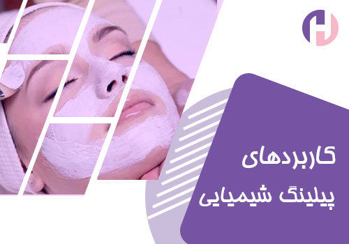 تصویر کابردهای پیلینگ شیمیایی