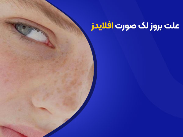 علت بروز لک صورت افلایذر