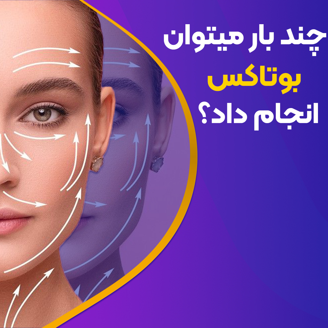 چند بار می‌توان بوتاکس کرد