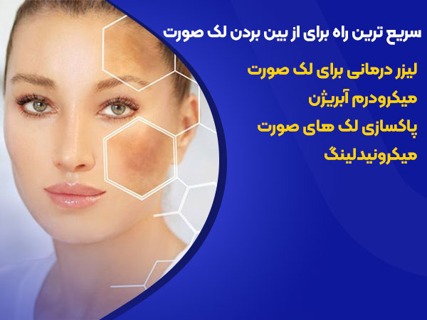 سریعترین راه برای از بین بردن لک صورت