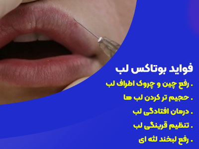 فواید بوتاکس لب چیست