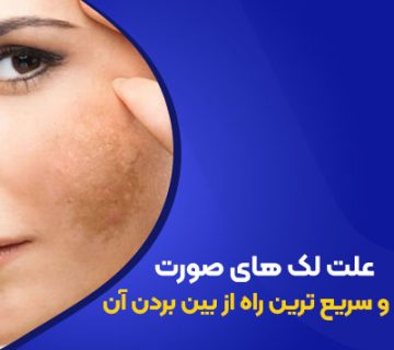 علت لک‌های صورت و سریع‌ترین راه از بین بردن آن