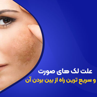 علت لک‌های صورت و سریع‌ترین راه از بین بردن آن