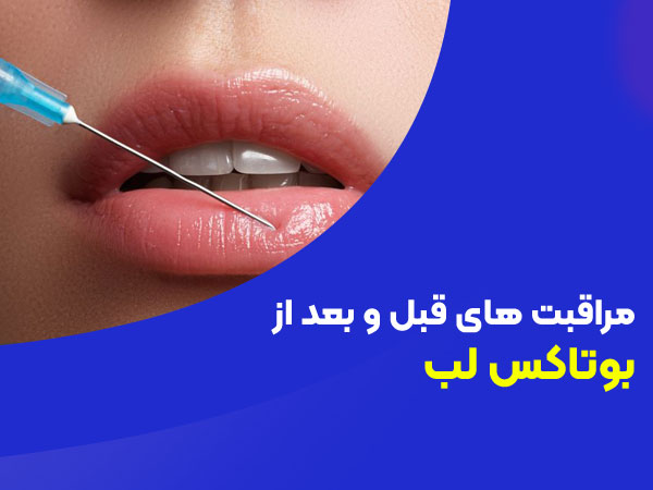 مراقبت های قبل و بعد از بوتاکس