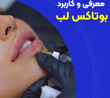 معرفی و کاربرد بوتاکس لب