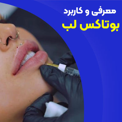 معرفی و کاربرد بوتاکس لب