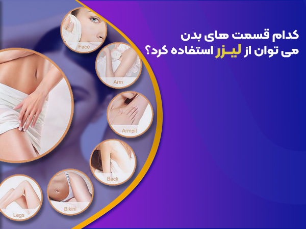 نقاطی که باید لیزر شود 