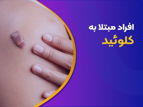 افراد مبتلا به کلوئید